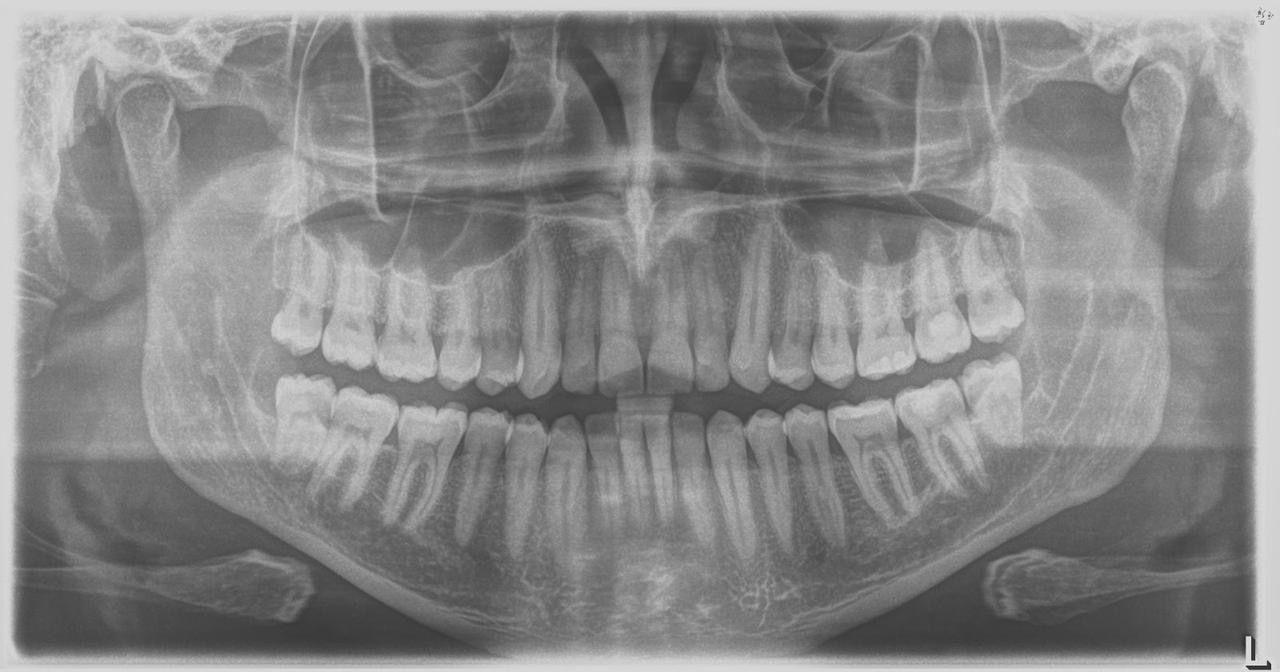 Sirona Orthophos XG 3 – Aparat Radiografik Panoramik Dixhital - Miniaturë 4