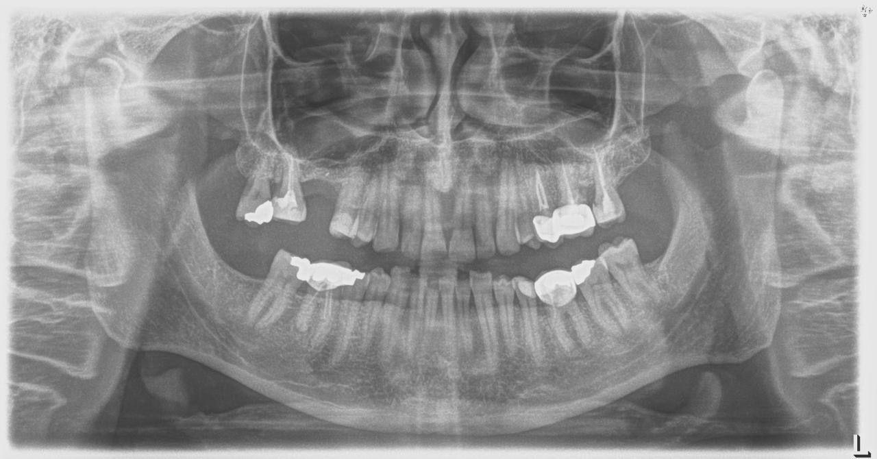 Sirona Orthophos XG 3 – Aparat Radiografik Panoramik Dixhital - Miniaturë 5