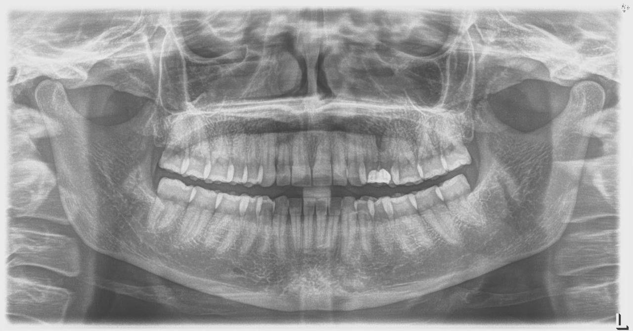 Sirona Orthophos XG 3 – Aparat Radiografik Panoramik Dixhital - Miniaturë 6
