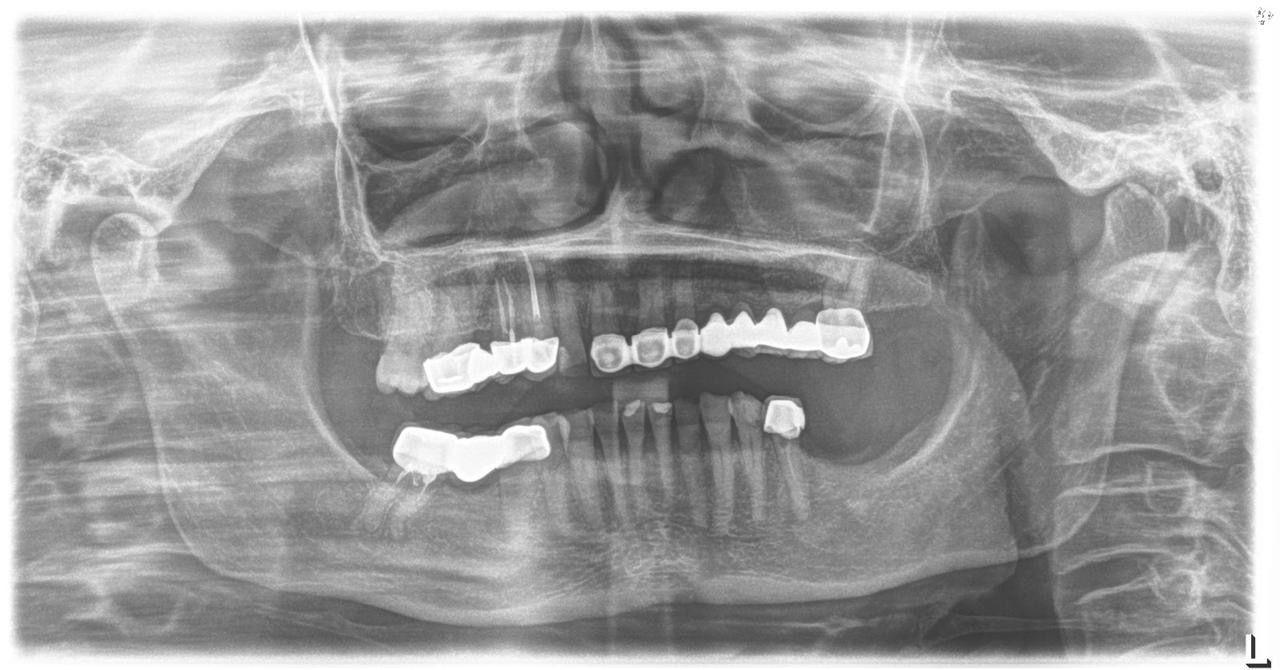 Sirona Orthophos XG 3 – Aparat Radiografik Panoramik Dixhital - Miniaturë 8